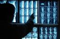 Doctor pointing to X-ray