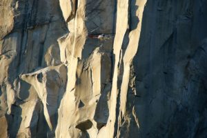 Thumb Reattached To Injured Hiker