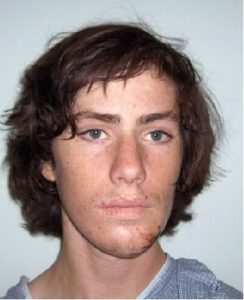 Teen Pleads Guilty