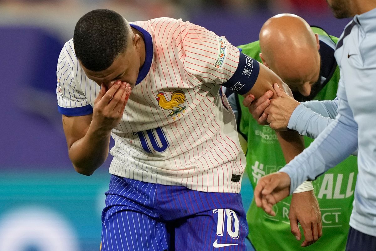 Kylian Mbappé’s nose injury places doubt on his continued involvement