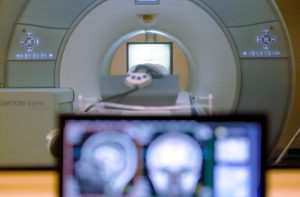 Pulled Into MRI Machine