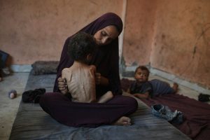 APTOPIX Mideast Wars Dying of Hunger