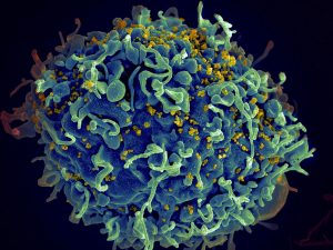 Global AIDS Report