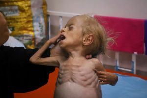 Mideast Wars Gaza Hunger