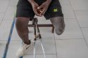 Congo Conflict Injured
