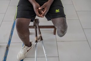 Congo Conflict Injured