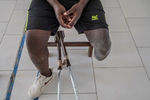 Congo Conflict Injured