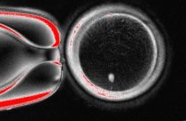 Fertility Research