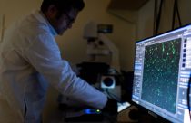 Be Well Autoimmune Diseases What to Know