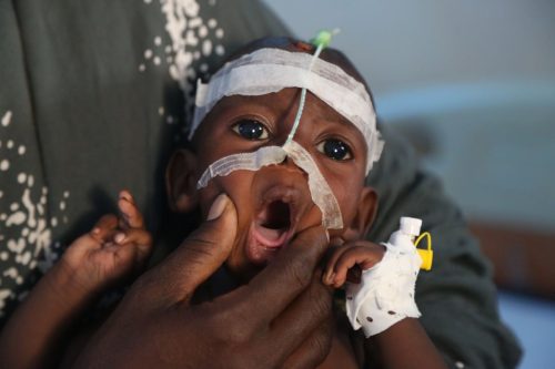 Somalia Struggling Hospitals