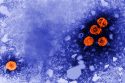 Guinea Bissau US Hepatitis B Study