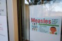 Measles