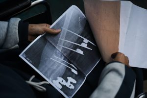 Mideast Wars Gaza Patients