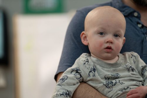 Measles-Babies