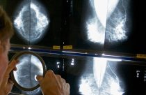 Be Well-Mammograms