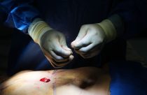 Cosmetic Interventions Ethics