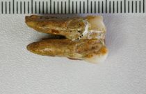 Ancient Human Teeth