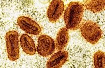 Scientists Charged Mpox