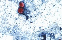 Cyclospora Outbreak History
