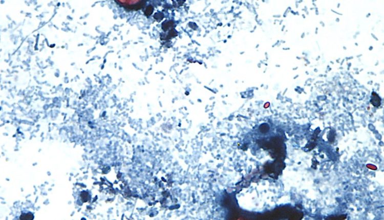 Cyclospora Outbreak