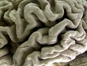Alzheimers-Blood Test