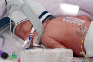 Australia Quadruplet Birth