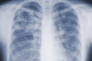 Mold Disease