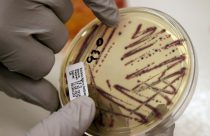 Alfalfa Sprouts Outbreak