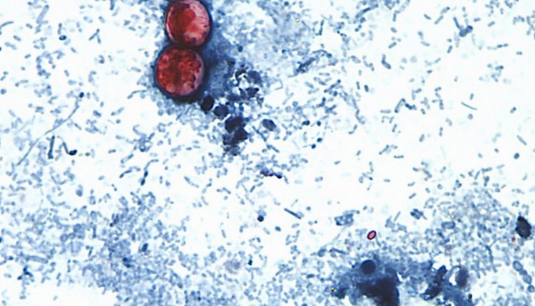 Cyclospora Outbreak