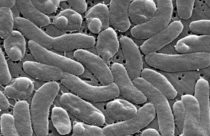 Deadly Bacteria Seawater