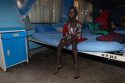 Nigeria Noma Disease