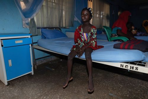 Nigeria Noma Disease