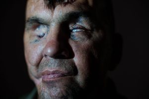 Russia Ukraine War Blind Soldier