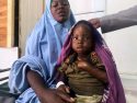 Somalia Malnutrition