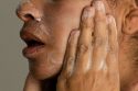 Be Well-Acne Treatments